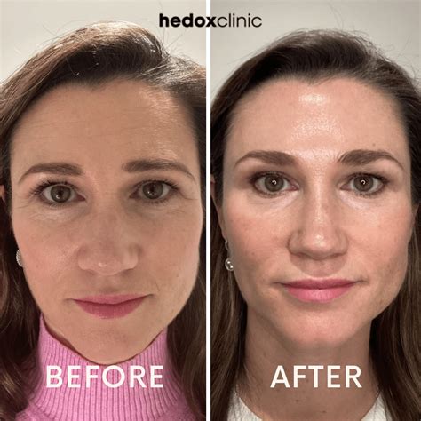 mummy makeover singapore|The Ultimate Mummy Makeover .